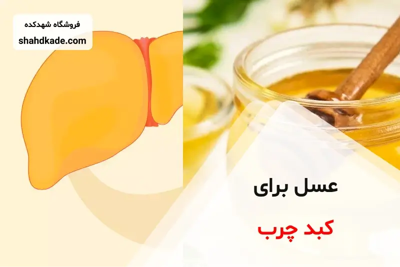 عسل برای کبد چرب